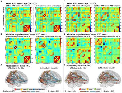 Comparative analysis of group information-guided independent component analysis and independent vector analysis for assessing brain functional network characteristics in autism spectrum disorder